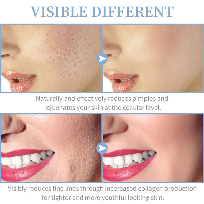 Nobélis™ 4 In 1 High Frequency Electrode Wand